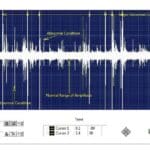 Article image of: Monitoren van traagdraaiende lagers & andere conditiebewaking-applicaties